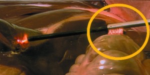 Fig. 1: Discouraging Results: According to an American College of Surgeons survey, 49 percent of surgeons haven't heard of capacitive coupling.